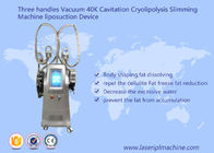 기계 Liposuctio 장치 3 손잡이를 체중을 줄이는 진공 40k 공동현상 Cryolipolysis