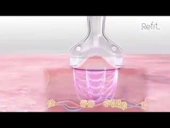 MLS05 가지고 다닐 수 있는 40K 공동화 진공 RF 초음파 셀룰라이트는 기기를 감소시킵니다