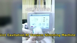 RF 진공 40K 캐비테이션 Velashaping 슬리밍 기계를 윤곽을 그리는 비침습적 360 롤러 본체