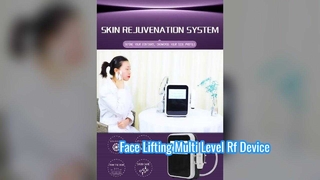 비침습적 60W 눈 관리 부드러운 잔주름 다단계 무선 주파수 장치