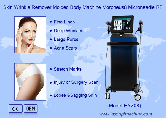 피부 주름 제거  Molded Body Machine Morpheus8 마이크로네일 RF