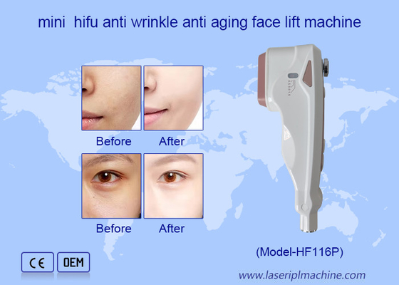 가정 사용 HIFU 관리 얼굴 주름 제거 피부 재생 얼굴 리프팅 기계