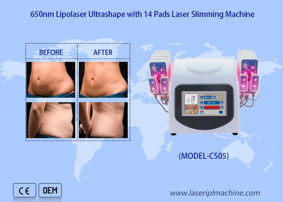 650nm Lipo 레이저는 셀룰라이트 지방 제거를 위한 레이저 지방 흡입 수술 기계를 덧댑니다