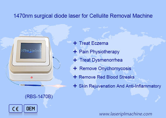 좋은 가격 1470nm 980nm 다이오드 레이저 지방분석 수술 레이저 장치 지방 용해 온라인으로