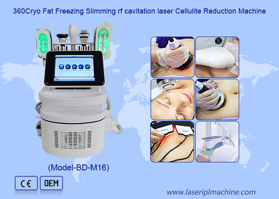 휴대용 cryolipolysis 뚱뚱한 동결 가정 cryolipolysis 지방 흡입 수술 기계